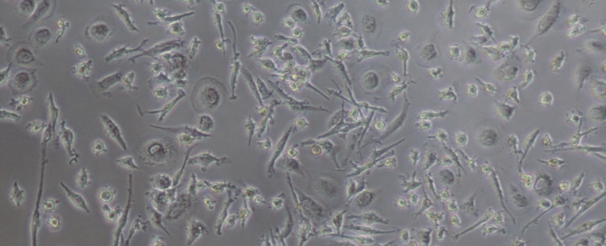 Microscopic view of kupffer cells