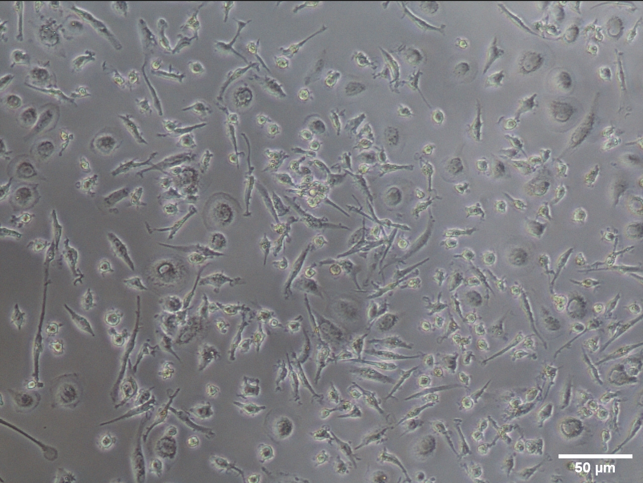 Microscopic view of kupffer cells