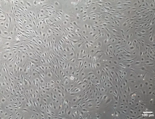 Liver Sinusoidal Endothelial Cells: Gatekeepers of Hepatic Microcirculation