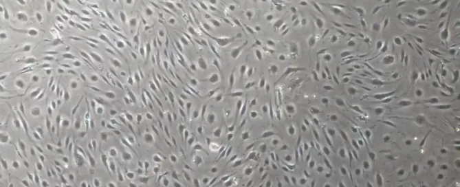 Liver Sinusoidal Endothelial Cells in Hepatic Microcirculation